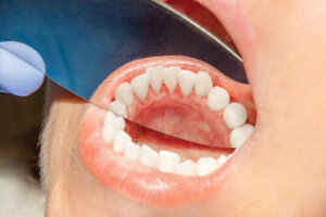 Long-Term Cannabis Use & Risk of Oral Cancer: What Ohio MMJ Patients Should Know Long-Term Cannabis Use & Risk of Oral Cancer: What Ohio MMJ Patients Should Know